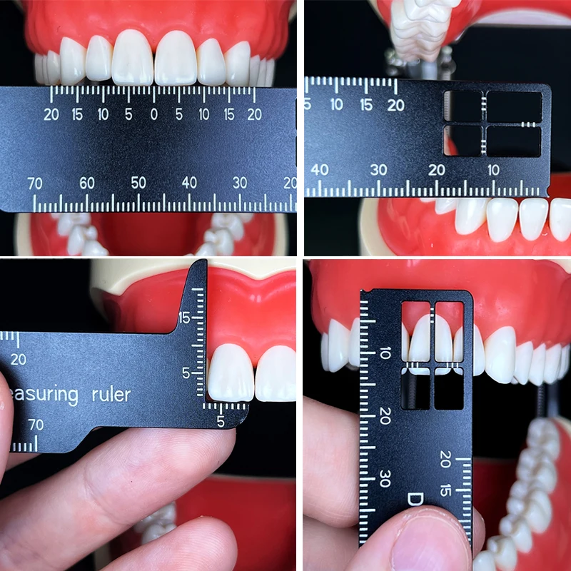 Règle de mesure des dents de p - Photography Rules avis et prix